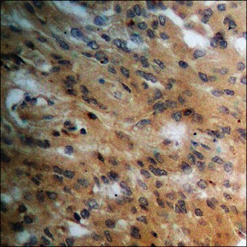 Anti-phospho-PPAR-&#947; (pSer112) antibody produced in rabbit affinity isolated antibody