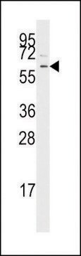 ANTI-TGF BETA RECEPTOR I (CENTER) antibody produced in rabbit IgG fraction of antiserum, buffered aqueous solution