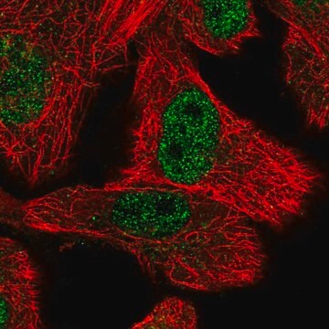 Anti-OSTC antibody produced in rabbit Prestige Antibodies&#174; Powered by Atlas Antibodies, affinity isolated antibody