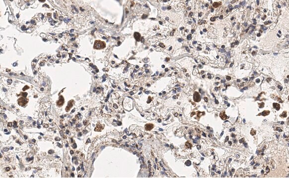 Anti-MRC1 Antibody, clone 1C9 ZooMAb&#174; Rabbit Monoclonal recombinant, expressed in HEK 293 cells