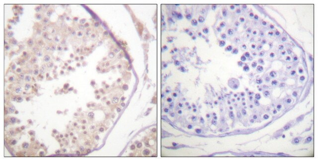 Anti-RAD52 antibody produced in rabbit affinity isolated antibody