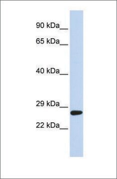 Anti-SETD4 antibody produced in rabbit affinity isolated antibody