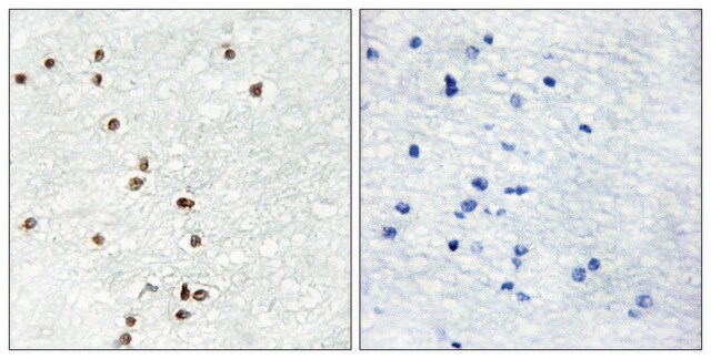 Anti-ZIC1 antibody produced in rabbit affinity isolated antibody