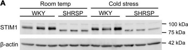 Anti-STIM1 (N-terminal) antibody produced in rabbit ~1&#160;mg/mL, affinity isolated antibody, buffered aqueous solution