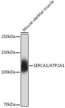 Anti-SERCA1/ATP2A1 antibody produced in rabbit