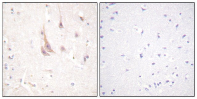 Anti-PKC &#950; antibody produced in rabbit affinity isolated antibody