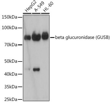 Anti-beta glucuronidase (GUSB) Antibody, clone 4U0E2, Rabbit Monoclonal