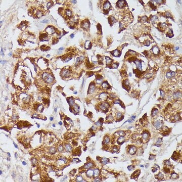 Anti-AGT antibody produced in rabbit