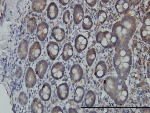 Monoclonal Anti-PCSK1 antibody produced in mouse clone 3D2, purified immunoglobulin, buffered aqueous solution