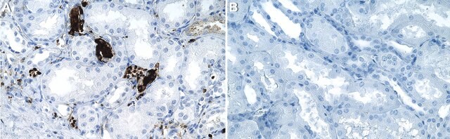 Anti-MCP-1 Antibody, clone 2G17 ZooMAb&#174; Rabbit Monoclonal recombinant, expressed in HEK 293 cells