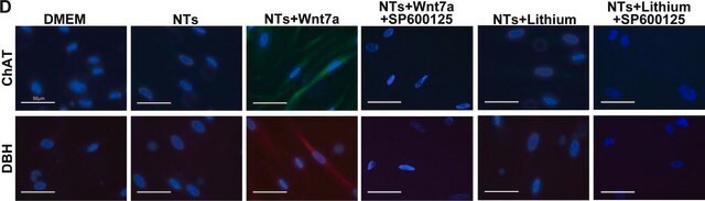 Anti-Dopamine &#946; Hydroxylase Antibody serum, Chemicon&#174;