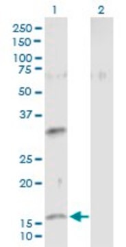 Anti-NMU antibody produced in mouse purified immunoglobulin, buffered aqueous solution