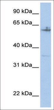 Anti-SPDEF (AB2) antibody produced in rabbit affinity isolated antibody