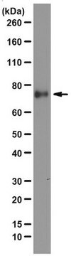 Anti-Kindlin-1 Antibody, clone 4A5.14 clone 4A5.14, from mouse