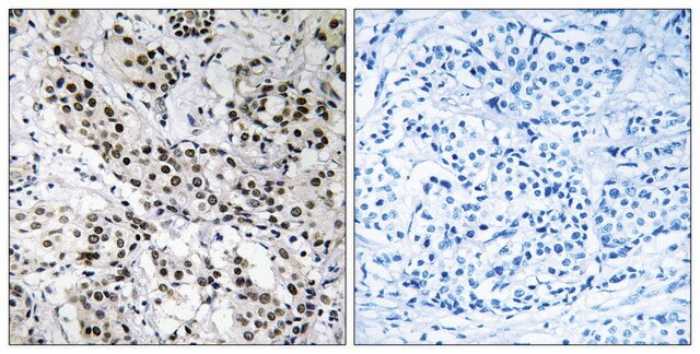 Anti-APBB2 antibody produced in rabbit affinity isolated antibody