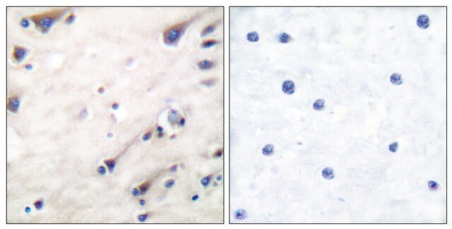 Anti-KSR antibody produced in rabbit affinity isolated antibody