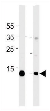 MONOCLONAL ANTI-MYOGLOBIN antibody produced in mouse clone 444CT19.2.1, IgG fraction of antiserum, buffered aqueous solution