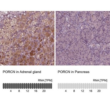 Anti-PORCN antibody produced in rabbit Prestige Antibodies&#174; Powered by Atlas Antibodies, affinity isolated antibody