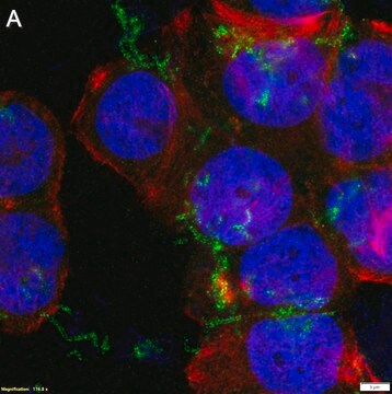 Anti-ROR2 clone XBR2-401 ZooMAb&#174; Rabbit Monoclonal recombinant, expressed in HEK 293 cells