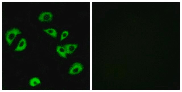 Anti-LILRB4 antibody produced in rabbit affinity isolated antibody