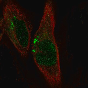 Monoclonal Anti-Adam10 Antibody Produced In Mouse Prestige Antibodies&#174; Powered by Atlas Antibodies, clone CL13814, affinity isolated antibody, buffered aqueous glycerol solution