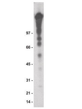 Anti-Phosphotyrosine Antibody, recombinant clone 4G10&#174;, agarose conjugate clone 4G10®, Upstate&#174;, from mouse