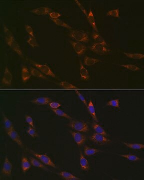 Anti-RPS3 Antibody, clone 3X2M4, Rabbit Monoclonal