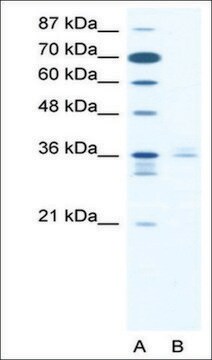 Anti-LHX3 (AB1) antibody produced in rabbit affinity isolated antibody