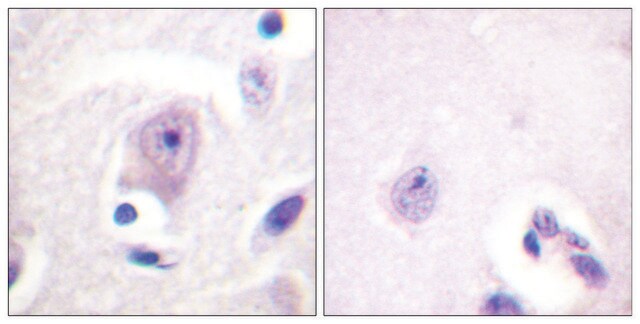 Anti-CDC6 antibody produced in rabbit affinity isolated antibody