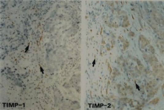 Anti-TIMP-2 Antibody, clone 67-4H11 clone 67-4H11, Chemicon&#174;, from mouse