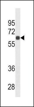 MONOCLONAL ANTI-CD138 (C-TERMINAL) antibody produced in mouse clone 587CT7.3.6.5, crude ascites, buffered aqueous solution