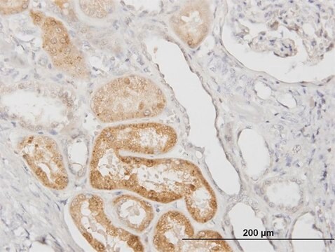 Monoclonal Anti-SERPINA3, (C-terminal) antibody produced in mouse clone 1C10, purified immunoglobulin, buffered aqueous solution