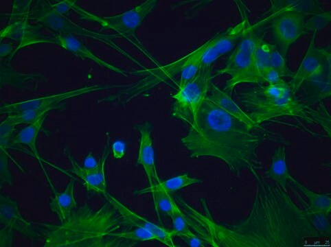 OSUMMER.5 Mouse NRAS-Mutant Melanoma Cell Line