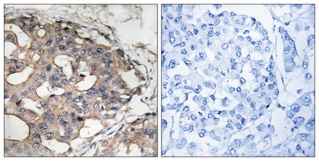 Anti-B-RAF antibody produced in rabbit affinity isolated antibody