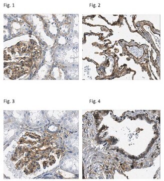 Anti-Integrin &#946;1 Antibody, clone N29 (Azide Free) clone N29, Chemicon&#174;, from mouse