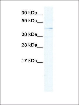 Anti-ARX (AB2) antibody produced in rabbit IgG fraction of antiserum