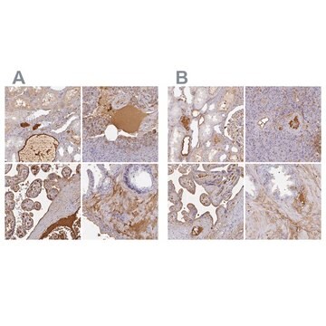 Anti-ALB antibody produced in rabbit Prestige Antibodies&#174; Powered by Atlas Antibodies, affinity isolated antibody, buffered aqueous glycerol solution