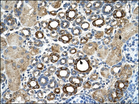 Anti-ST14 antibody produced in rabbit affinity isolated antibody