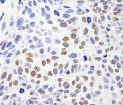 Rabbit anti-SMC1 Antibody, Affinity Purified