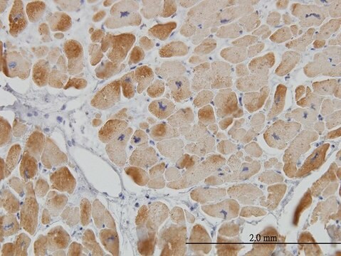 Monoclonal Anti-ACADVL antibody produced in mouse clone 5D3, purified immunoglobulin, buffered aqueous solution