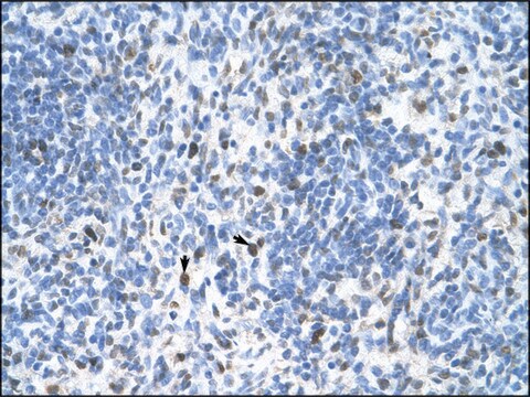 Anti-PCNA IgG fraction of antiserum