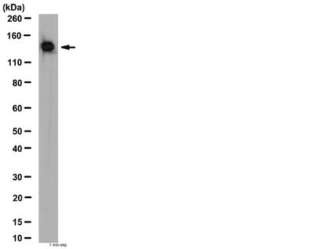 Anti-Vinculin Antibody from rabbit, purified by affinity chromatography