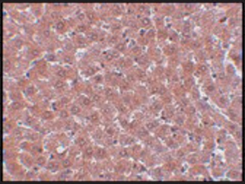 Anti-JMJD2A antibody produced in rabbit affinity isolated antibody, buffered aqueous solution