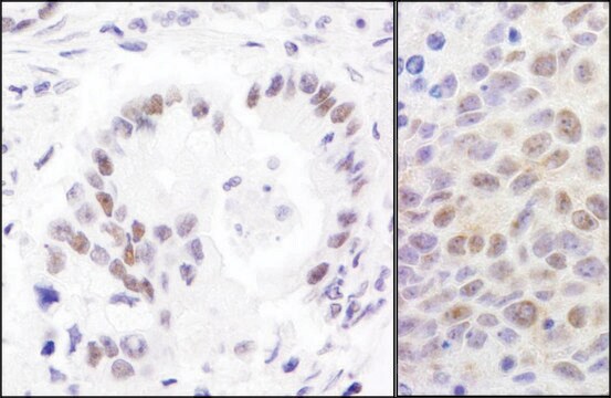 Rabbit anti-RPA70 Antibody, Affinity Purified Powered by Bethyl Laboratories, Inc.