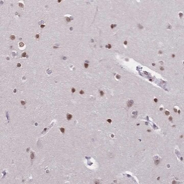 Anti-CBX7 antibody produced in rabbit Prestige Antibodies&#174; Powered by Atlas Antibodies, affinity isolated antibody, buffered aqueous glycerol solution