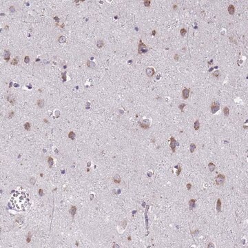 Anti-TMEM106B antibody produced in rabbit Prestige Antibodies&#174; Powered by Atlas Antibodies, affinity isolated antibody, buffered aqueous glycerol solution