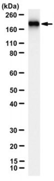 Anti-Complement C5 Antibody, clone SIM 225-3.2.1