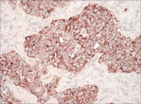 Rabbit anti-HSP60 Antibody, Affinity Purified Powered by Bethyl Laboratories, Inc.