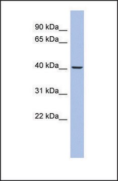 Anti-PRKACB antibody produced in rabbit affinity isolated antibody