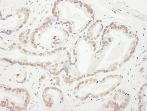 Rabbit anti-CBX5 Antibody, Affinity Purified Powered by Bethyl Laboratories, Inc.